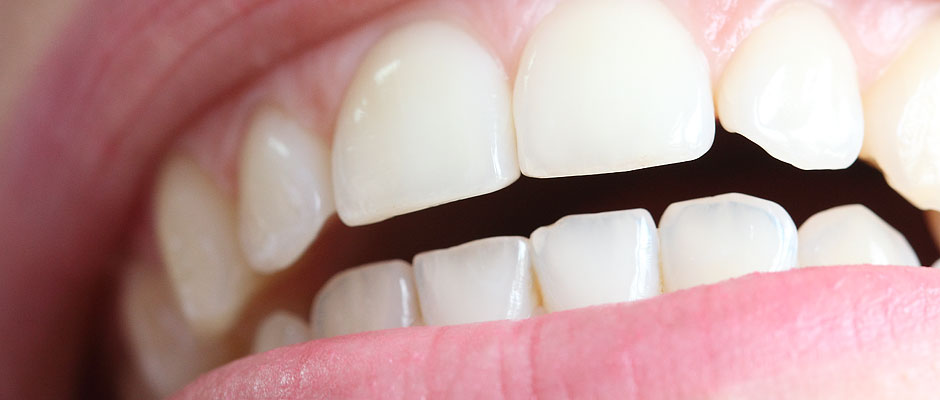 dental health abroad